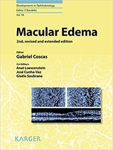 Macular Edema (Developments in Ophthalmology, Vol. 58)