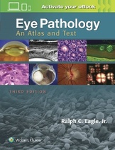 Eye Pathology: An Atlas and Text, 3e