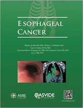 Esophageal Cancer 1e